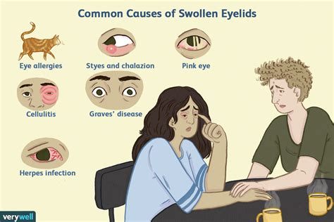 One-Sided Swollen Eye: Causes & Fast Relief