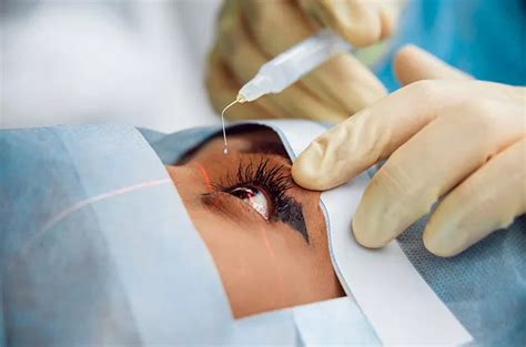 Operasi LASIK