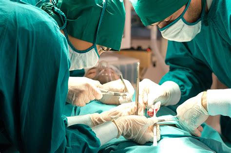 Operasi Pengangkatan