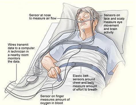Option 1: The In-Lab Sleep Study (Polysomnography - PSG)