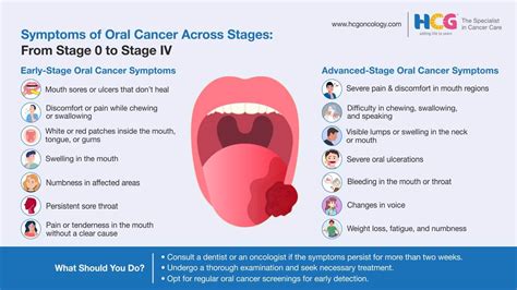 Oral Cancer: 5 Signs & Effective Treatments