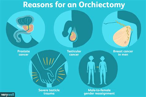 Orchiectomy Side Effects