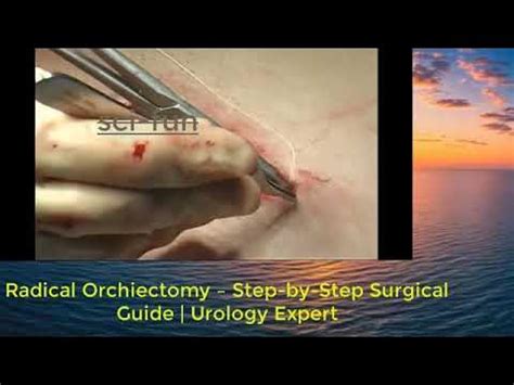 Orchiectomy Steps
