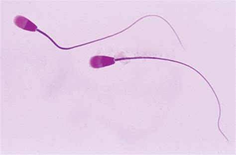 Original Human Sperm Image