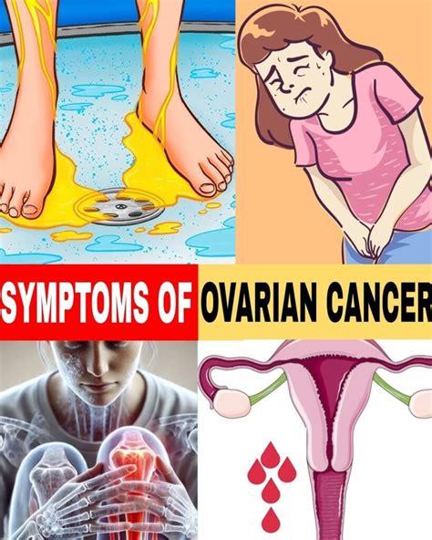 Ovarian Cancer: 6 Subtle Signs to Know.