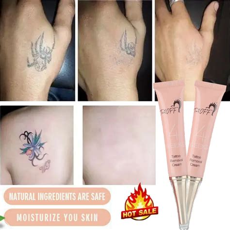 Tattoo Removal Cream / Oxyfade Kit Tattoo Removal Cream At