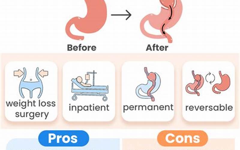Ozempic After Gastric Bypass: What You Need to Know