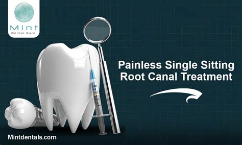 Painless Root Canal