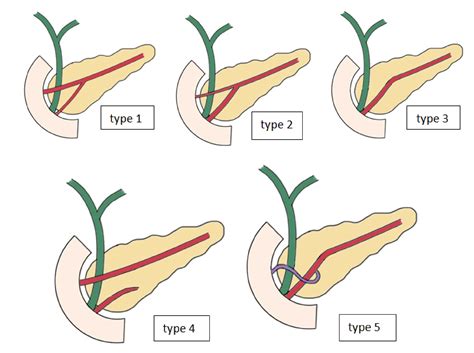 Normal Anatomy Of The Gallbladder and Pancreas