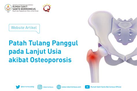 Panggul & Kelahiran: Anatomi, Pengaruh, Solusi.
