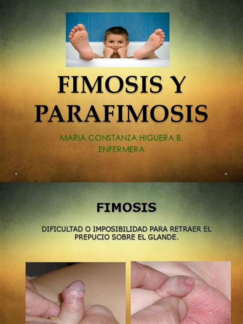 La parafimosis by ricardo sepulveda Issuu