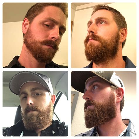 Patchy Beard Progress