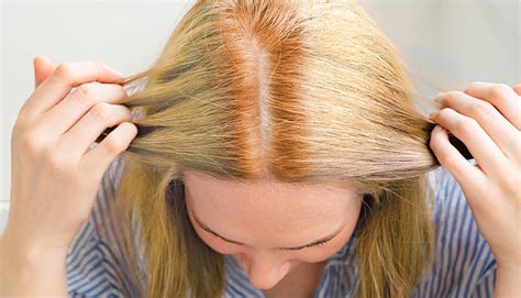 Patchy Hair Color