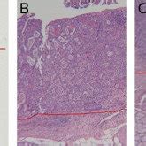 Pathological Examination: The Microscopic View