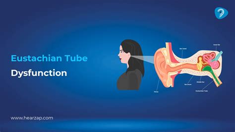Exercises For Eustachian Tube Dysfunction | PDF | Mucus | Human Head