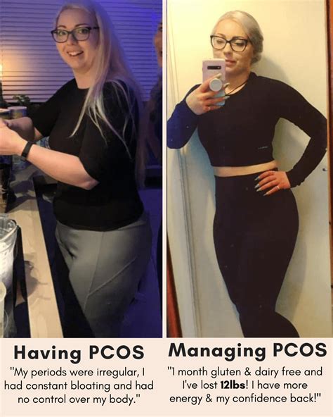 Transform Your Body in Just 30 Days: The Ultimate Guide to Achieving PCOS Weight Loss Success