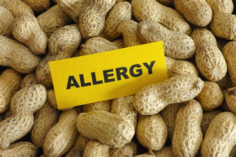 New diagnostic test may make it easier to identify peanut allergies in