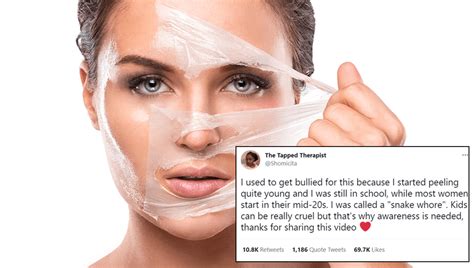 Unveiling the Truth Behind Post-Menstrual Peeling Skin: Causes and Remedies