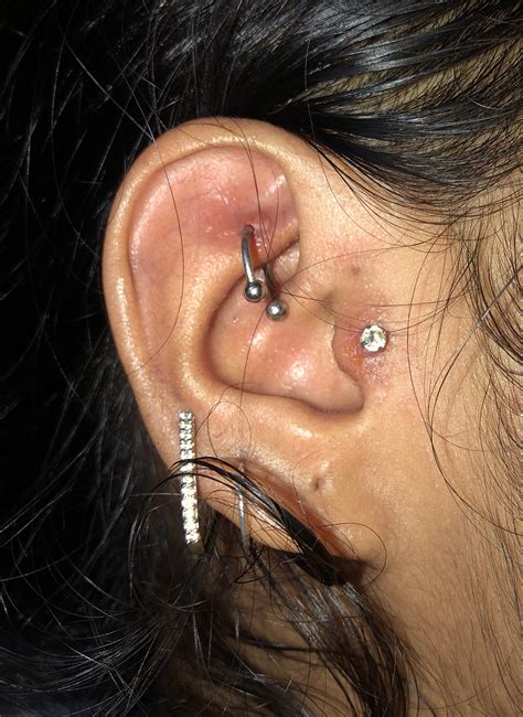 Farewell to Flaky Woes: A Comprehensive Guide to Banish Peeling Skin Around Your Piercing