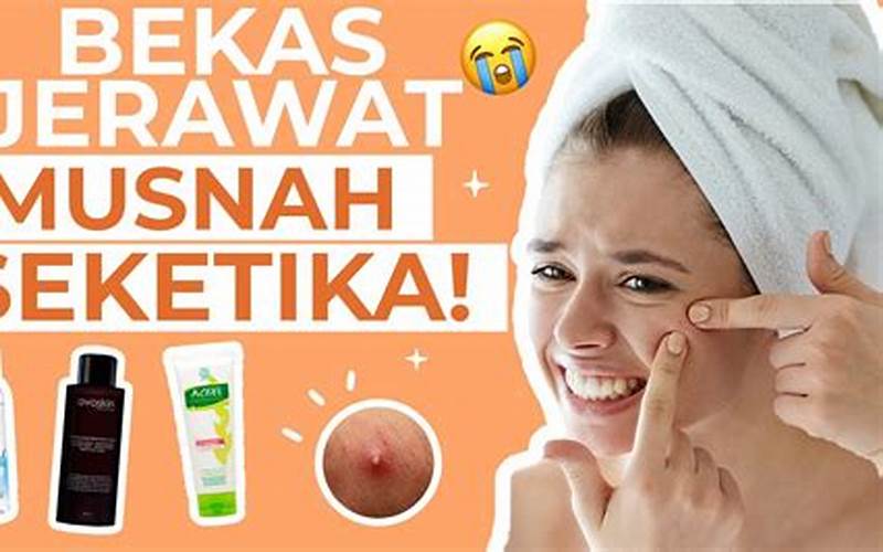 Pelumas Wajah Yang Dapat Menghilangkan Bekas Jerawat