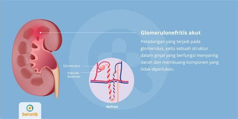 Pencegahan Penyakit dan Vaksinasi Glomerulonefritis Akut