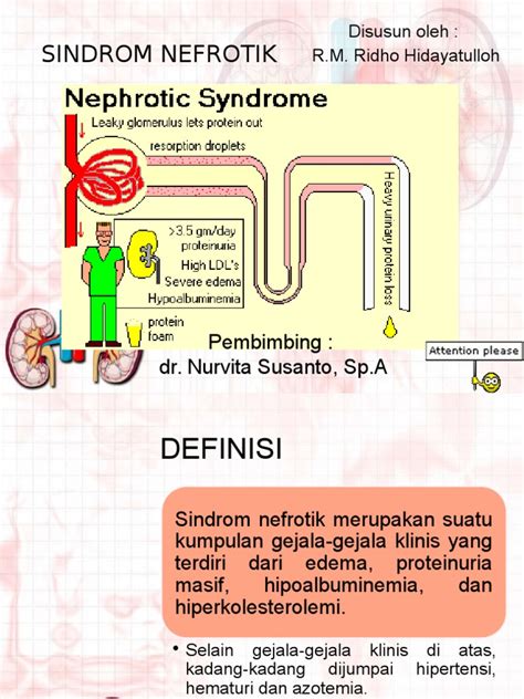Ilustrasi Pentingnya Kesehatan Sindrom Nefrotik
