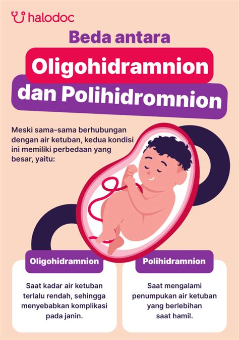 Oligohidramnion: Penyebab dan Gejala Kurang Air Ketuban pada Kehamilan