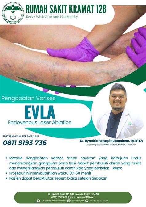 Pengobatan Varises