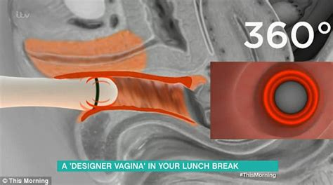 Penis In Vagina Cam