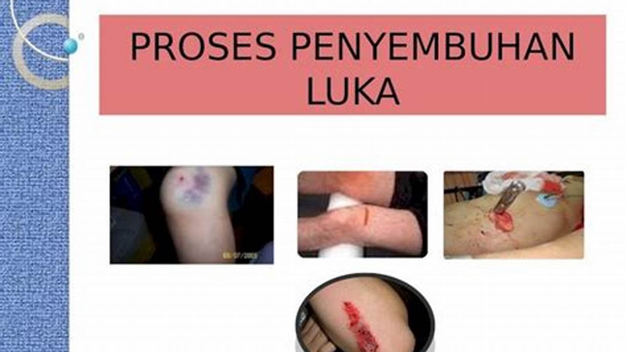 Penyembuhan Luka, Tips