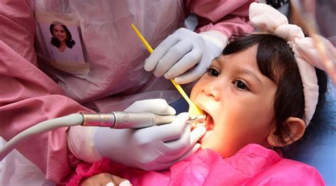 Perawatan Gigi yang Mungkin Tidak Mendukung Pemutihan Gigi