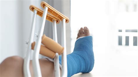 Perawatan Gips: Tips Cepat & Efektif