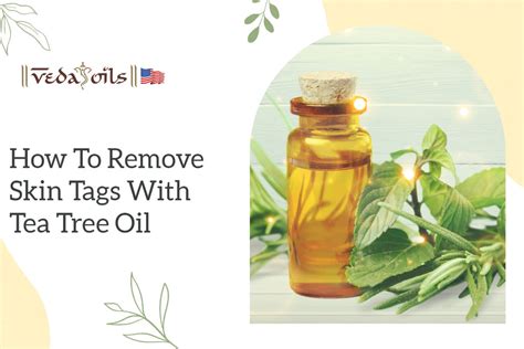 Say Goodbye to Painful Perianal Skin Tags with Soothing Tea Tree Oil Treatment