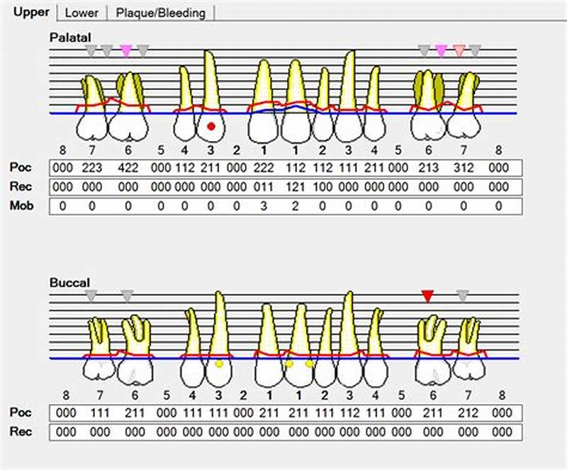 Perio Chart Example