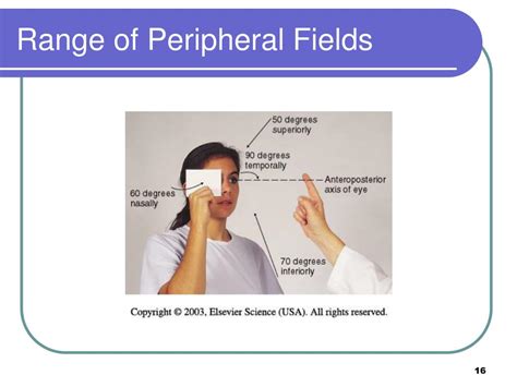 Peripheral Vision Screening