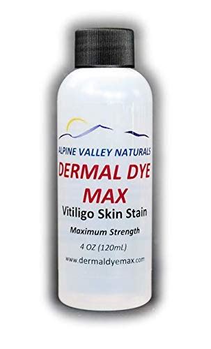 Permanently Conceal Vitiligo with Skin Dye Treatment