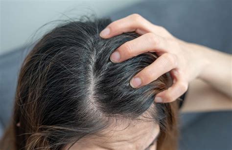 Diagnosing Your Scalp Problem