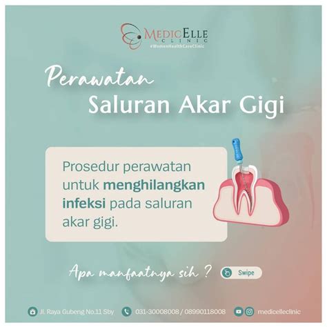 Pertimbangkan Perawatan Profesional