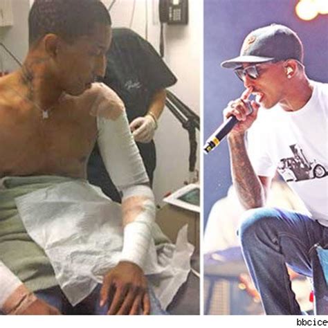 Pharrell Williams Tattoo Removal Before And After