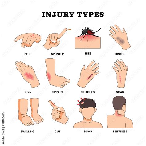 Physical Trauma and Injury