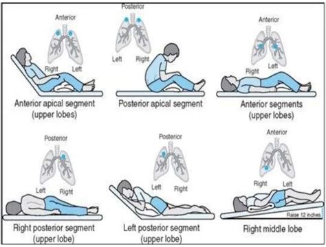 Physical and Postural Issues Affecting Respiration