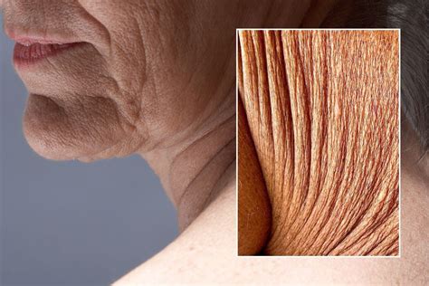 Unveiling the Mystery of Crepey Skin: A Compelling Visual Journey Through Pictures