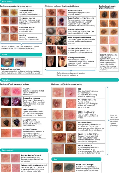 Detecting Pigmented Lesions of the Skin for Better Health