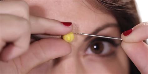 Pimple Popping for Beginners: A Step-by-Step Guide