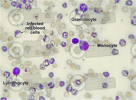 Plasmodium Berghei