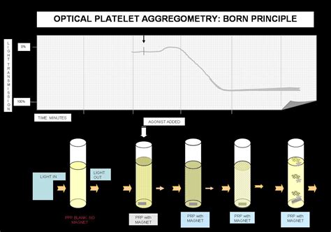 Platelet Aggregation Study Test and interpretation