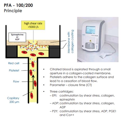 Platelet Function Analyzer Test and interpretation