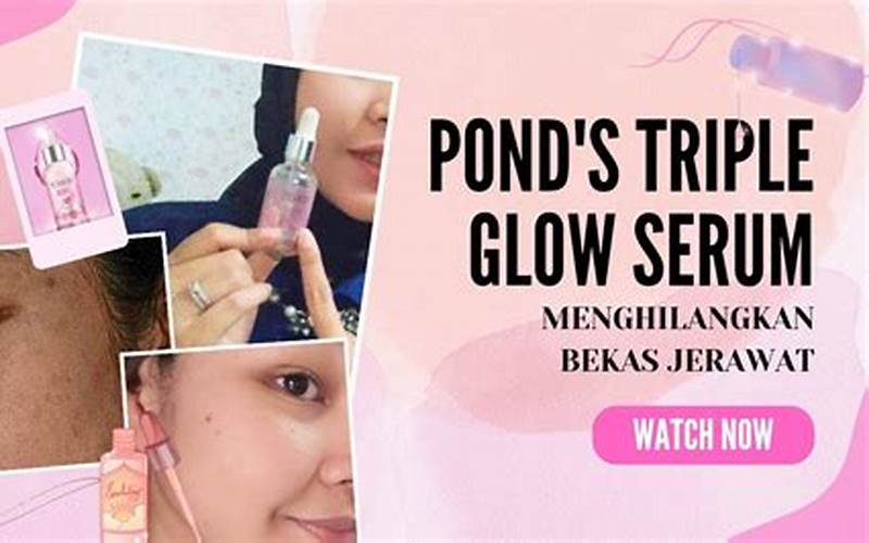 Ponds Untuk Menghilangkan Bekas Jerawat