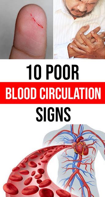 Poor Circulation and Slow Healing