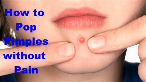 Pop A Pimple